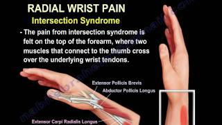 Wrist Paincauses and treatmentPart 2  Everything You Need To Know  Dr Nabil Ebraheim [upl. by Anits130]