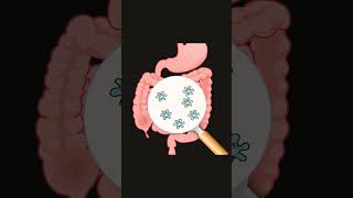 Correct your gut dysbiosis by following this step 👆🏻guthealth youtubeshorts [upl. by Darrelle918]