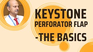 The Keystone perforator flap Basics [upl. by Ahsinrat35]