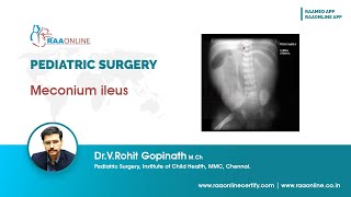 Meconium ileus PediatricSurgery Surgery Meconiumileus [upl. by Enait]