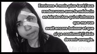 Keratocône ma maladie des yeux Opérations lentilleslunettes anneaux intracornéencrosslinking [upl. by Ardeed]