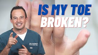 HOW CAN YOU TELL IF YOU BROKE YOUR PINKY TOE Dr Nick Campitelli [upl. by Zara399]