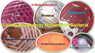 Various Common Bacteria Colony morphology E coli Klebsiella Staphylococcus Pseudomonas and More [upl. by Laram]