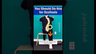 Pelvic Tilt for Scoliosis Scoliosis Stretching [upl. by Notyalc657]