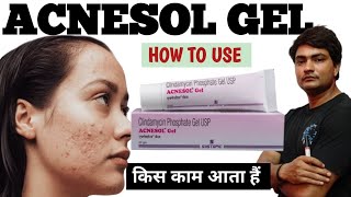 acnesol gel  acnesol gel uses in hindi  acnesol gel review  acnesol gel how to use  acnesol [upl. by Elvia629]