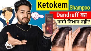 Ketokem Shampoo Review  Ketokem Anti Dandruff Shampoo [upl. by Rolat511]