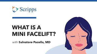 What Is a Mini Facelift with Salvatore Pacella MD  San Diego Health [upl. by Sulihpoeht]