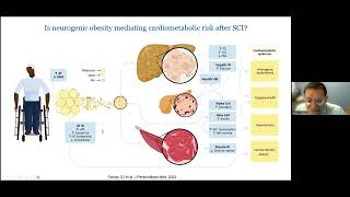 Neurogenic Obesity Energetics and Eating Behavior in SCI [upl. by Etteneg]