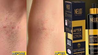 Neud after hair removal lotion review how to use hair removal lotion [upl. by Eizus]