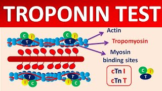 Troponin test and its significance [upl. by Patrizius899]