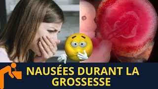 Nausées durant la grossesse  Un bon signe [upl. by Ecnerolf]