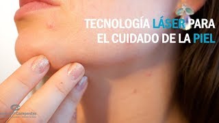 Tecnología láser para quitar manchas en la piel [upl. by Notniuqal]