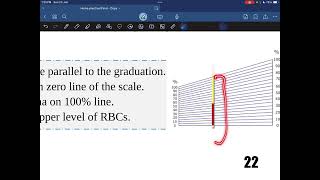 Hematocrit value  Practical hematology  Dr Saiko [upl. by Spatola]