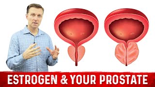 How To Fix Enlarged Prostate Explained By Dr Berg [upl. by Mcnelly]