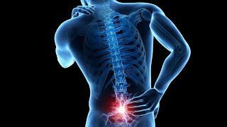 Neurologist Discusses Back Pain That Isnt Back Pain [upl. by Liamaj]