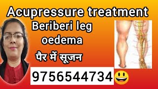 Beriberi Acupressure treatment Oedema शोफ बेरीबेरी swelling सूजन beriberi oedema swelling painful [upl. by Aisatsan]