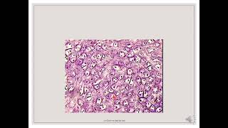 Histology Slides Series Episode 4  Cartilages and Bone [upl. by Ymaral]