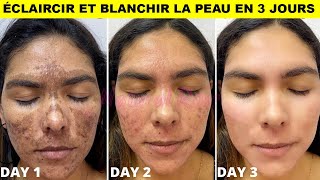 ÉCLAIRCIR ET BLANCHIR LA PEAU EN 3 JOURSSe débarrasser de la pigmentationtache et cicatrice dacné [upl. by Damaris]