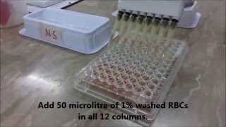 AJs Science 2 How to perform Hemagglutination assay HA Test [upl. by Merc]