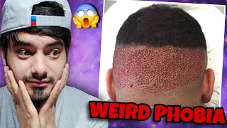 Most Weirdest Phobias that People actually have  part 2 😱 [upl. by Caldera]