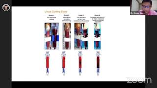 Anticoagulation in Hemodialysis by Dr Karan Saraf [upl. by Lovett]