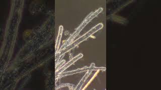 Coenocytic Hyphae [upl. by Dorcas]