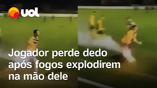 Jogador perde dedo após fogos de artifício explodirem na mão dele após jogo na Bélgica vídeo [upl. by Machutte]