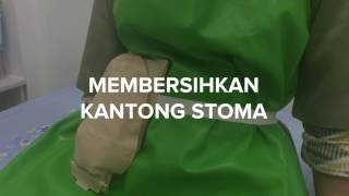 Membersihkan kantong kolostomi [upl. by Roper241]