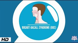 Bogart–Bacall syndrome Causes Signs and Symptoms Diagnosis and Treatment [upl. by Fellows]