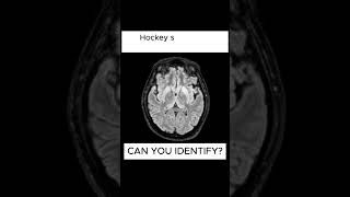 X ray quiz 37 nursing nursingstudent doctor USMLE MBBS hospital anatomy ctscan radiology [upl. by Ettegroeg]