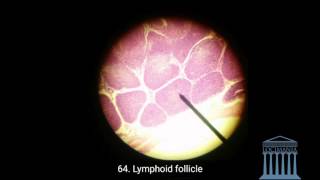 Histology  Vermiform Appendix [upl. by Ggerg]