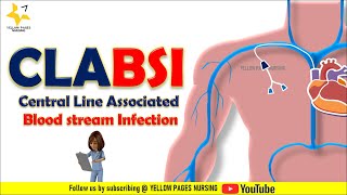 CLABSI  Central line related bloodstream infection  CLABSI Bundle  Types of CVCs [upl. by Bunnie730]