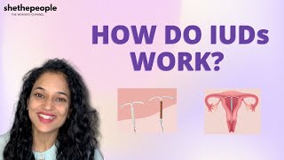 What you should know before getting an IUD  Answers Dr Theertha Shetty [upl. by Godric333]