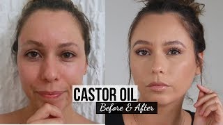 30 Days of Castor Oil For Eyebrow Growth [upl. by Werda]