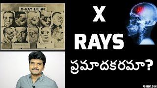 Xrays are dangerous Xrays ప్రమాదకరమా [upl. by Ing]