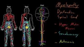 Syndrome Myelopathy [upl. by Tips]