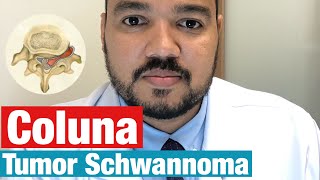 O que é o tumor Schwannoma  Coluna Vertebral [upl. by Varick]