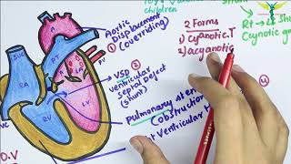 Tetralogy of Fallot TOF [upl. by Harlow772]