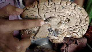 Brain anatomy by Dr Shilpi Mam MMC2 [upl. by Nikola]