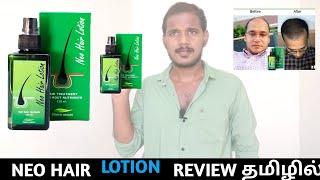 Neo hair lotion review in tamil trending hair lotion in tamil hair regrow lotion mr surya tamil [upl. by Kirby732]