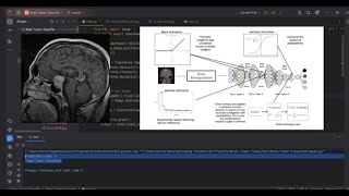 Brain Tumor Detection and Classifier DEEP LEARNING Model  PyTorch CNN [upl. by Cindelyn]