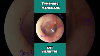 Tympanic membrane anatomy under 60 seconds  USMLE NCLEX  NEET PG [upl. by Nerraj]