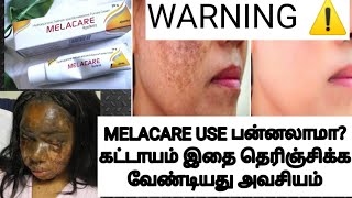 MELACARE CREAM SIDEEFFECTS TAMILSKIN WHITENING CREAM REVIEWTRENDING BEAUTY TIPS [upl. by Noryahs688]