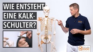 Wie entsteht eine Kalkschulter [upl. by Lemrej724]