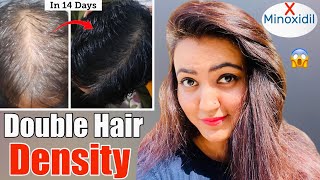 14 Days Challenge  Try This Hair Growth Remedy To Get Double Hair Density amp Thick Long Hair❤️ [upl. by Sivel471]