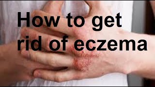 Effective Remedies for Eczema [upl. by Primalia]