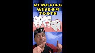 Wisdom Tooth Removal How Dentists Assess and Plan the Extraction  View Mobile Dental [upl. by Sidnala]