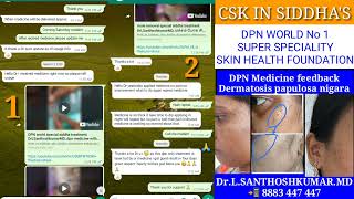 face black dots dermatosis papulosa nigara tamil DPN face black spots face karuppu pulli mole [upl. by Yesnel]