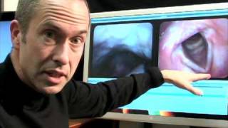 Laryngology 101 Laryngoscopy the art of seeing the voice vocal cords [upl. by Akilaz]