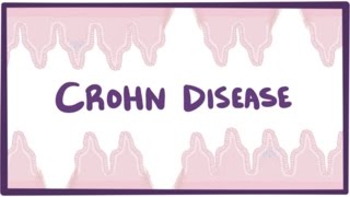 Crohns disease Crohn disease  causes symptoms amp pathology [upl. by Naamana248]